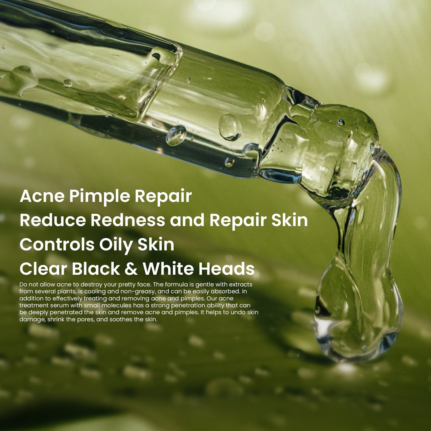 Acne Treatment Face Serum 30ml